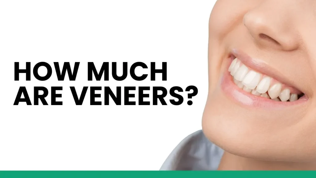 how much are veneers